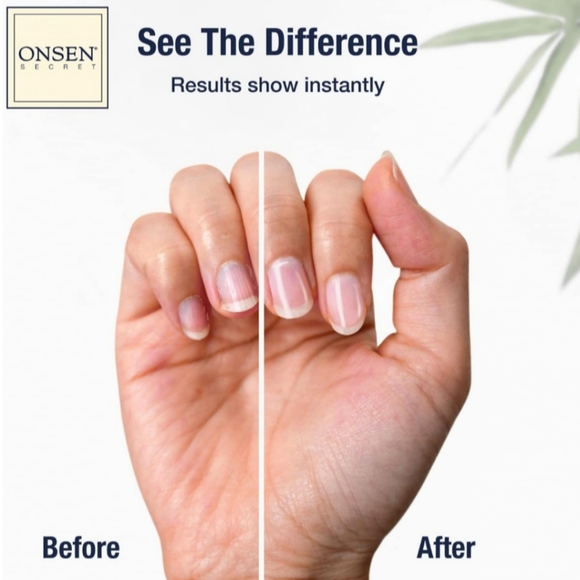 ๐ 3/$15 - Onsen Cuticle Conditioning Serum - Picture 2 of 5
